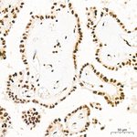 YTHDC1 Antibody in Immunohistochemistry (Paraffin) (IHC (P))