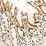 YTHDC1 Antibody in Immunohistochemistry (Paraffin) (IHC (P))