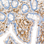 c-Cbl Antibody in Immunohistochemistry (Paraffin) (IHC (P))