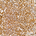 c-Cbl Antibody in Immunohistochemistry (Paraffin) (IHC (P))