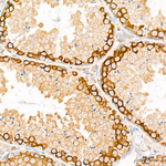 c-Cbl Antibody in Immunohistochemistry (Paraffin) (IHC (P))