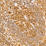 c-Cbl Antibody in Immunohistochemistry (Paraffin) (IHC (P))