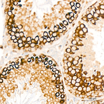 c-Cbl Antibody in Immunohistochemistry (Paraffin) (IHC (P))
