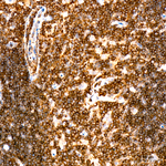 c-Cbl Recombinant Rabbit Monoclonal Antibody (1J1E3)