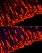 TFF1 Antibody in Immunohistochemistry (Paraffin) (IHC (P))