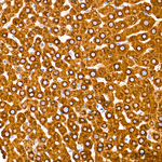 CYP2E1 Antibody in Immunohistochemistry (Paraffin) (IHC (P))