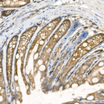 PTP1B Antibody in Immunohistochemistry (Paraffin) (IHC (P))