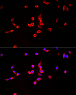 Monoacylglycerol Lipase Recombinant Rabbit Monoclonal Antibody (10B9L3)