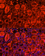 Monoacylglycerol Lipase Antibody in Immunohistochemistry (Paraffin) (IHC (P))
