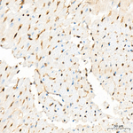 Monoacylglycerol Lipase Antibody in Immunohistochemistry (Paraffin) (IHC (P))