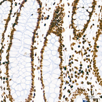 H4K16ac Antibody in Immunohistochemistry (Paraffin) (IHC (P))