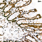 H4K16ac Antibody in Immunohistochemistry (Paraffin) (IHC (P))