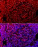 GLI2 Antibody in Immunohistochemistry (Paraffin) (IHC (P))
