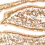 GLI2 Antibody in Immunohistochemistry (Paraffin) (IHC (P))