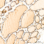 GLI2 Antibody in Immunohistochemistry (Paraffin) (IHC (P))