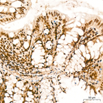 GLI2 Antibody in Immunohistochemistry (Paraffin) (IHC (P))