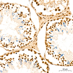 GLI2 Antibody in Immunohistochemistry (Paraffin) (IHC (P))