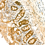 GLI2 Antibody in Immunohistochemistry (Paraffin) (IHC (P))