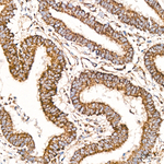 COX1 Antibody in Immunohistochemistry (Paraffin) (IHC (P))