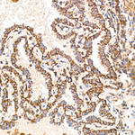 COX1 Antibody in Immunohistochemistry (Paraffin) (IHC (P))