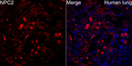 NPC2 Recombinant Rabbit Monoclonal Antibody (7J1J2)