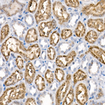 NPC2 Antibody in Immunohistochemistry (Paraffin) (IHC (P))