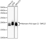 NPC2 Antibody in Western Blot (WB)