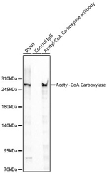 Acetyl-CoA Carboxylase Antibody in Immunoprecipitation (IP)