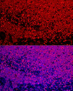 SATB1 Recombinant Rabbit Monoclonal Antibody (1W7F4)