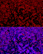 SATB1 Antibody in Immunohistochemistry (Paraffin) (IHC (P))