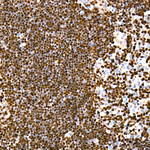 SATB1 Antibody in Immunohistochemistry (Paraffin) (IHC (P))