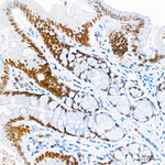 SATB1 Antibody in Immunohistochemistry (Paraffin) (IHC (P))
