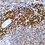 SATB1 Antibody in Immunohistochemistry (Paraffin) (IHC (P))