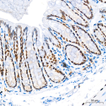 SATB1 Antibody in Immunohistochemistry (Paraffin) (IHC (P))
