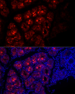 Pepsinogen I Recombinant Rabbit Monoclonal Antibody (2N7U10)