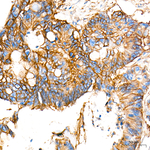 ASCT2 Recombinant Rabbit Monoclonal Antibody (3S6I0)