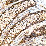 ASCT2 Antibody in Immunohistochemistry (Paraffin) (IHC (P))