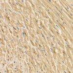 S100A1 Antibody in Immunohistochemistry (Paraffin) (IHC (P))