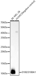 S100A1 Antibody in Western Blot (WB)