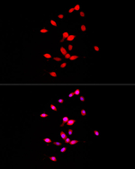 FGF1 Recombinant Rabbit Monoclonal Antibody (8C10P4)