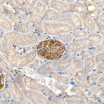 Nephrin Recombinant Rabbit Monoclonal Antibody (7Y5U6)