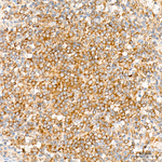 NF2 Antibody in Immunohistochemistry (Paraffin) (IHC (P))