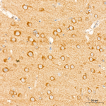 NF2 Antibody in Immunohistochemistry (Paraffin) (IHC (P))