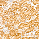 NF2 Antibody in Immunohistochemistry (Paraffin) (IHC (P))