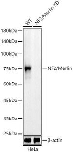 NF2 Antibody in Western Blot (WB)