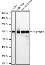 NF2 Antibody in Western Blot (WB)