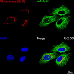 Glutaminase Antibody in Immunocytochemistry (ICC/IF)
