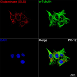 Glutaminase Antibody in Immunocytochemistry (ICC/IF)