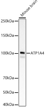 ATP1A4 Antibody in Western Blot (WB)