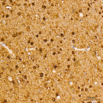 JNK1 Antibody in Immunohistochemistry (Paraffin) (IHC (P))
